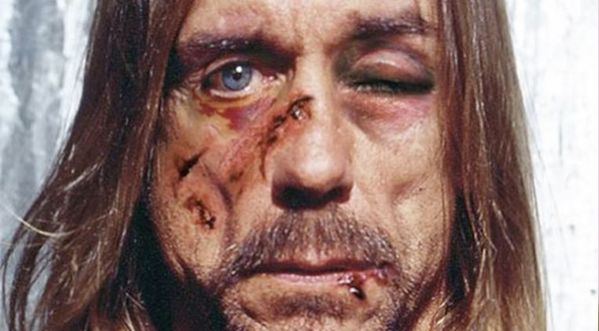 Iggy Pop, visage tuméfié, torturé par Justin Bieber !